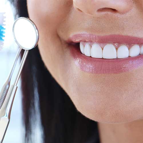 Profilassi-delle-carie